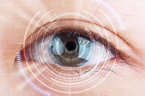 Cataract surgery